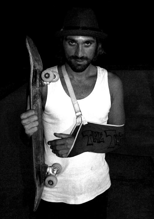 Scott, broken arm